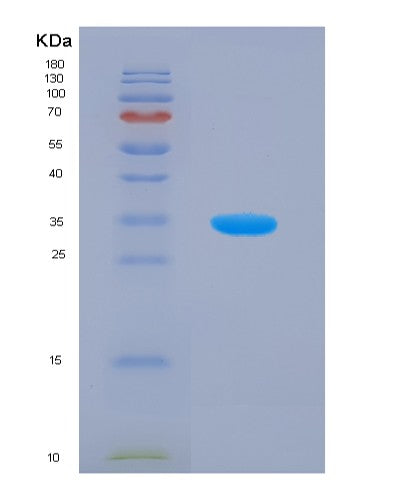 SDS-PAGE analysis of Human MAPK9 (Mitogen-Activated Protein Kinase 9) - Recombinant Protein, showing >95% purity under 15% SDS-PAGE (Reduced)