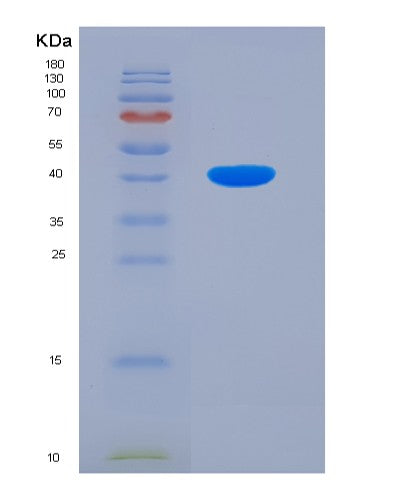 SDS-PAGE analysis of Human CRKL (Crk-Like Protein) - Recombinant Protein, showing >90% purity under 15% SDS-PAGE (Reduced)