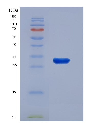 SDS-PAGE analysis of Mouse Fst (Follistatin) - Recombinant Protein, showing >95% purity under 15% SDS-PAGE (Reduced)