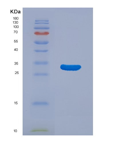 SDS-PAGE analysis of Human MAP2K3 (Dual Specificity Mitogen-Activated Protein Kinase Kinase 3) - Recombinant Protein, showing >85% purity under 15% SDS-PAGE (Reduced)