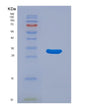 SDS-PAGE analysis of Human MAP2K3 (Dual Specificity Mitogen-Activated Protein Kinase Kinase 3) - Recombinant Protein, showing >85% purity under 15% SDS-PAGE (Reduced)
