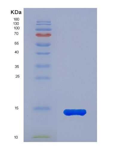 SDS-PAGE analysis of Human XCL1 (Lymphotactin) - Recombinant Protein, showing >95% purity under 15% SDS-PAGE (Reduced)