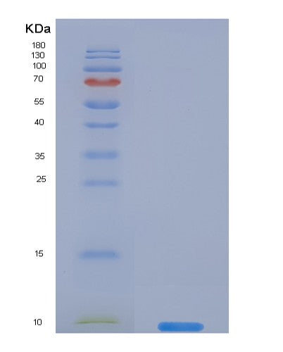 SDS-PAGE analysis of Human SERPINB4 (Serpin B4) - Recombinant Protein, showing >95% purity under 15% SDS-PAGE (Reduced)
