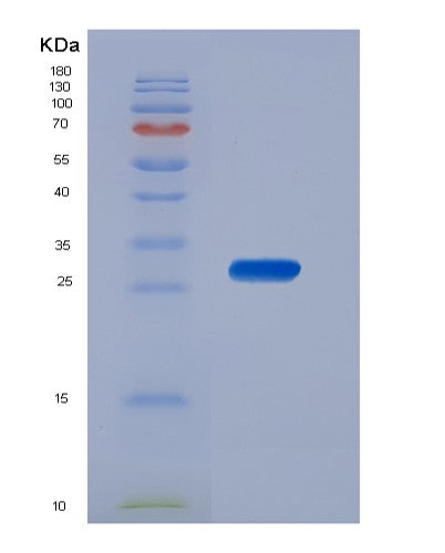 SDS-PAGE analysis of Human CSNK1A1 (Casein Kinase I Isoform Alpha) - Recombinant Protein, showing >90% purity under 15% SDS-PAGE (Reduced)