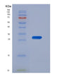 SDS-PAGE analysis of Human CSNK1A1 (Casein Kinase I Isoform Alpha) - Recombinant Protein, showing >90% purity under 15% SDS-PAGE (Reduced)