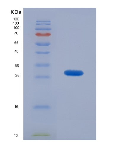 SDS-PAGE analysis of Human CAMLG (Guided Entry Of Tail-Anchored Proteins Factor Camlg) - Recombinant Protein, showing >85% purity under 15% SDS-PAGE (Reduced)