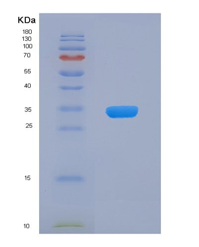 SDS-PAGE analysis of Human CDC34 (Ubiquitin-Conjugating Enzyme E2 R1) - Recombinant Protein, showing >90% purity under 15% SDS-PAGE (Reduced)