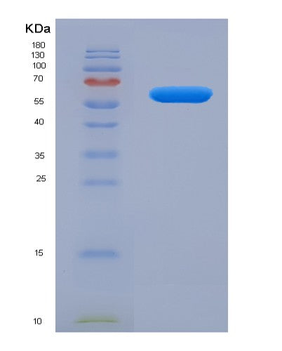SDS-PAGE analysis of Human STAR (Steroidogenic Acute Regulatory Protein, Mitochondrial) - Recombinant Protein, showing >90% purity under 15% SDS-PAGE (Reduced)