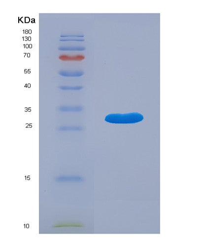 SDS-PAGE analysis of Human ACADVL (Very Long-Chain Specific Acyl-Coa Dehydrogenase, Mitochondrial) - Recombinant Protein, showing >90% purity under 15% SDS-PAGE (Reduced)