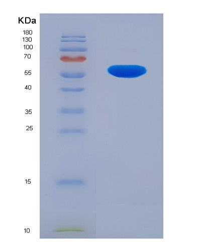 SDS-PAGE analysis of Human RARRES1 (Retinoic Acid Receptor Responder Protein 1) - Recombinant Protein, showing >90% purity under 15% SDS-PAGE (Reduced)