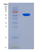 SDS-PAGE analysis of Human RARRES1 (Retinoic Acid Receptor Responder Protein 1) - Recombinant Protein, showing >90% purity under 15% SDS-PAGE (Reduced)