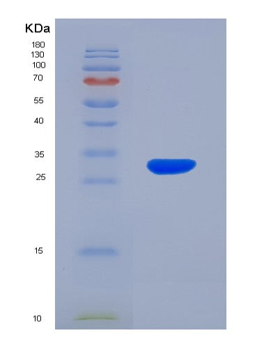SDS-PAGE analysis of Human RGS19 (Regulator Of G-Protein Signaling 19) - Recombinant Protein, showing >90% purity under 15% SDS-PAGE (Reduced)