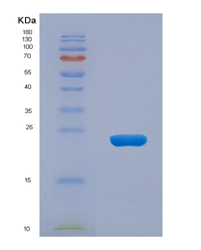 SDS-PAGE analysis of Human RGS4 (Regulator Of G-Protein Signaling 4) - Recombinant Protein, showing >90% purity under 15% SDS-PAGE (Reduced)