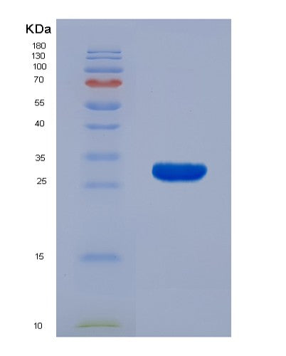 SDS-PAGE analysis of Human KLK7 (Kallikrein-7) - Recombinant Protein, showing >90% purity under 15% SDS-PAGE (Reduced)