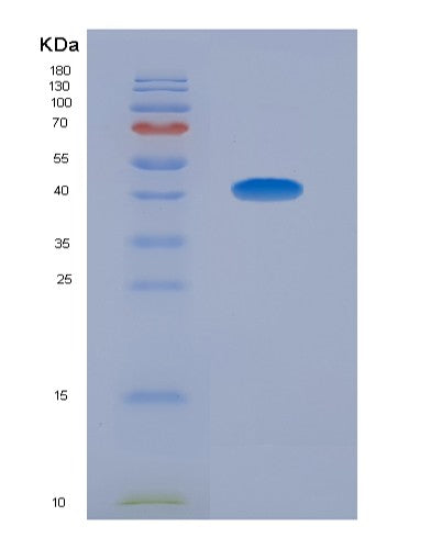 SDS-PAGE analysis of Human SMCP (Sperm Mitochondrial-Associated Cysteine-Rich Protein) - Recombinant Protein, showing >95% purity under 15% SDS-PAGE (Reduced)