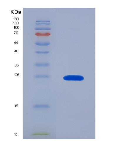 SDS-PAGE analysis of Human CAMP (Cathelicidin Antimicrobial Peptide) - Recombinant Protein, showing >95% purity under 15% SDS-PAGE (Reduced)