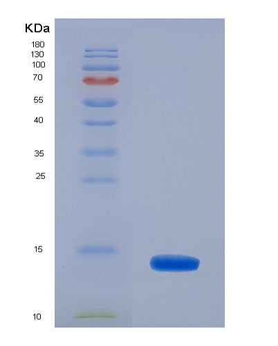 SDS-PAGE analysis of Human CRIP1 (Cysteine-Rich Protein 1) - Recombinant Protein, showing >90% purity under 15% SDS-PAGE (Reduced)