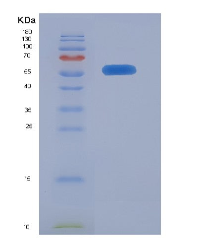 SDS-PAGE analysis of Human ANXA11 (Annexin A11) - Recombinant Protein, showing >85% purity under 15% SDS-PAGE (Reduced)