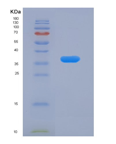 SDS-PAGE analysis of Human RAB7A (Ras-Related Protein Rab-7A) - Recombinant Protein, showing >90% purity under 15% SDS-PAGE (Reduced)