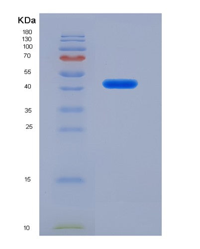 SDS-PAGE analysis of Human DAP (Death-Associated Protein 1) - Recombinant Protein, showing >85% purity under 15% SDS-PAGE (Reduced)