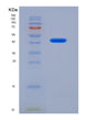 SDS-PAGE analysis of Human DAP (Death-Associated Protein 1) - Recombinant Protein, showing >85% purity under 15% SDS-PAGE (Reduced)