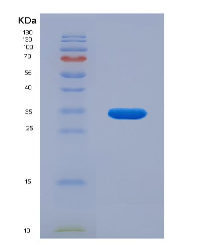 SDS-PAGE analysis of Human SERPINA7 (Thyroxine-Binding Globulin) - Recombinant Protein, showing >90% purity under 15% SDS-PAGE (Reduced)