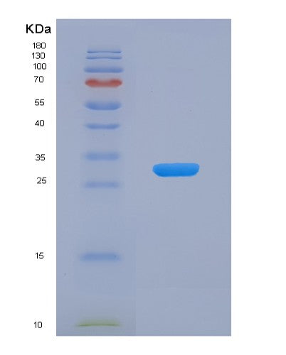 SDS-PAGE analysis of Human F9 (Coagulation Factor Ix) - Recombinant Protein, showing >90% purity under 15% SDS-PAGE (Reduced)