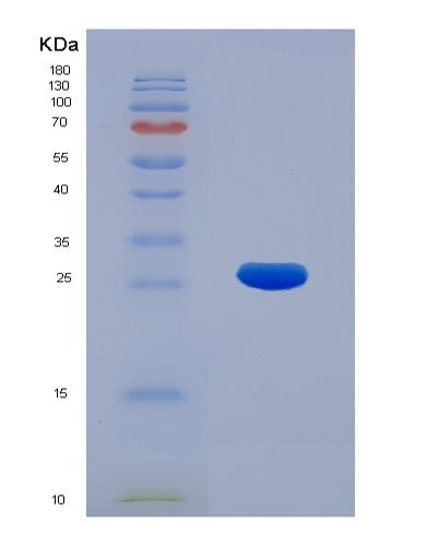 SDS-PAGE analysis of Human KPNA2 (Importin Subunit Alpha-1) - Recombinant Protein, showing >85% purity under 15% SDS-PAGE (Reduced)