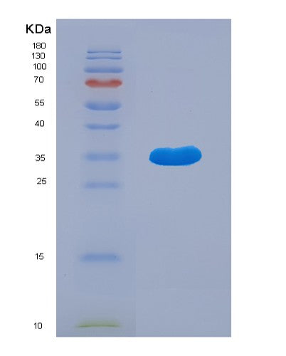 SDS-PAGE analysis of Human MAP2K6 (Dual Specificity Mitogen-Activated Protein Kinase Kinase 6) - Recombinant Protein, showing >90% purity under 15% SDS-PAGE (Reduced)