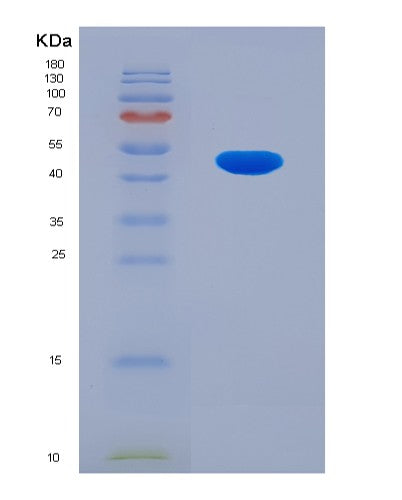 SDS-PAGE analysis of Human ARHGDIB (Rho Gdp-Dissociation Inhibitor 2) - Recombinant Protein, showing >85% purity under 15% SDS-PAGE (Reduced)
