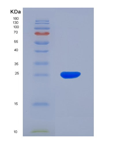 SDS-PAGE analysis of Human HK2 (Hexokinase-2) - Recombinant Protein, showing >85% purity under 15% SDS-PAGE (Reduced)
