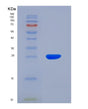 SDS-PAGE analysis of Human HK2 (Hexokinase-2) - Recombinant Protein, showing >85% purity under 15% SDS-PAGE (Reduced)