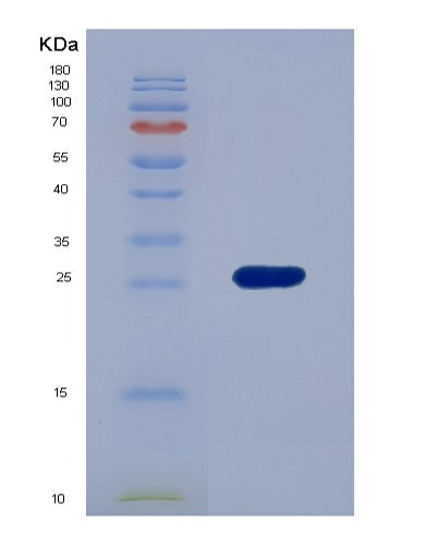 SDS-PAGE analysis of Human EFNA3 (Ephrin-A3) - Recombinant Protein, showing >95% purity under 15% SDS-PAGE (Reduced)