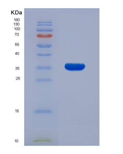 SDS-PAGE analysis of Human EFNB2 (Ephrin-B2) - Recombinant Protein, showing >95% purity under 15% SDS-PAGE (Reduced)