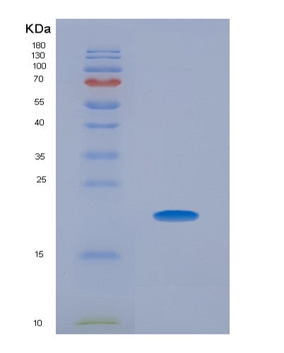 SDS-PAGE analysis of Human THOP1 (Thimet Oligopeptidase) - Recombinant Protein, showing >90% purity under 15% SDS-PAGE (Reduced)