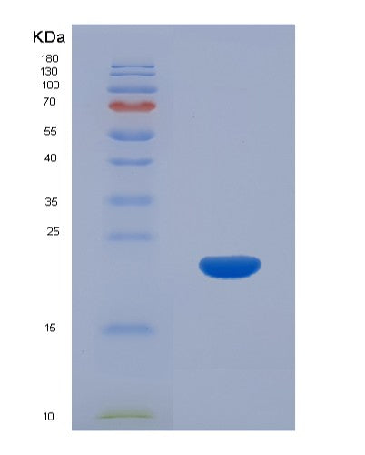SDS-PAGE analysis of Human CEBPG (Ccaat/Enhancer-Binding Protein Gamma) - Recombinant Protein, showing >85% purity under 15% SDS-PAGE (Reduced)