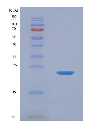 SDS-PAGE analysis of Human TNFSF13B (Tumor Necrosis Factor Ligand Superfamily Member 13B) - Recombinant Protein, showing >90% purity under 15% SDS-PAGE (Reduced)