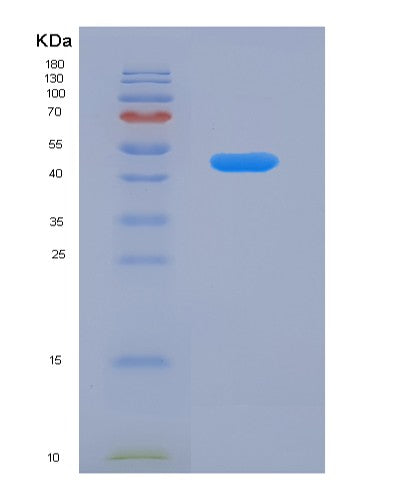 SDS-PAGE analysis of Human ATXN3 (Ataxin-3) - Recombinant Protein, CAT# BLT-08370P showing >85% purity under 15% SDS-PAGE (Reduced)