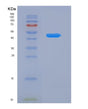 SDS-PAGE analysis of Human ATXN3 (Ataxin-3) - Recombinant Protein, CAT# BLT-08370P showing >85% purity under 15% SDS-PAGE (Reduced)