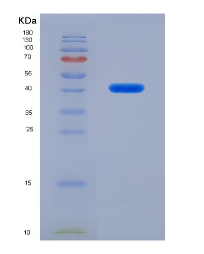 SDS-PAGE analysis of Human OAZ1 (Ornithine Decarboxylase Antizyme 1) - Recombinant Protein, showing >95% purity under 15% SDS-PAGE (Reduced)
