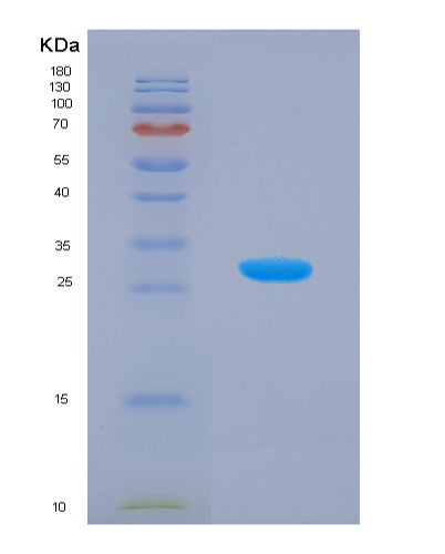 SDS-PAGE analysis of Human PRKAG1 (5'-Amp-Activated Protein Kinase Subunit Gamma-1) - Recombinant Protein, showing >85% purity under 15% SDS-PAGE (Reduced)