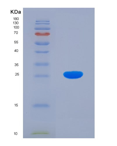 SDS-PAGE analysis of Human BCAT1 (Branched-Chain-Amino-Acid Aminotransferase, Cytosolic) - Recombinant Protein, showing >85% purity under 15% SDS-PAGE (Reduced)