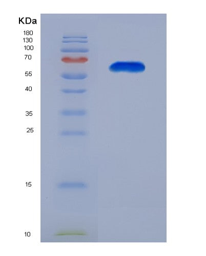 SDS-PAGE analysis of Human CFTR (Cystic Fibrosis Transmembrane Conductance Regulator) - Recombinant Protein, showing >90% purity under 15% SDS-PAGE (Reduced)