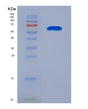 SDS-PAGE analysis of Human CFTR (Cystic Fibrosis Transmembrane Conductance Regulator) - Recombinant Protein, showing >90% purity under 15% SDS-PAGE (Reduced)