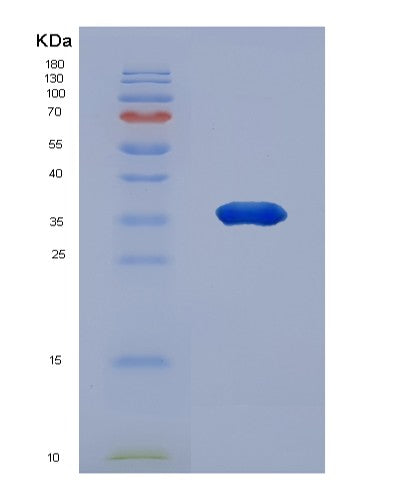SDS-PAGE analysis of Human NAPA (Alpha-Soluble Nsf Attachment Protein) - Recombinant Protein, showing >90% purity under 15% SDS-PAGE (Reduced)