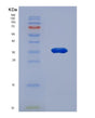 SDS-PAGE analysis of Human NAPA (Alpha-Soluble Nsf Attachment Protein) - Recombinant Protein, showing >90% purity under 15% SDS-PAGE (Reduced)