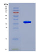 SDS-PAGE analysis of Human MFAP2 (Microfibrillar-Associated Protein 2) - Recombinant Protein, showing >95% purity under 15% SDS-PAGE (Reduced)