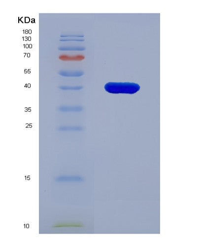 SDS-PAGE analysis of Human MFAP3 (Microfibril-Associated Glycoprotein 3) - Recombinant Protein, showing >90% purity under 15% SDS-PAGE (Reduced)