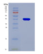 SDS-PAGE analysis of Human MFAP3 (Microfibril-Associated Glycoprotein 3) - Recombinant Protein, showing >90% purity under 15% SDS-PAGE (Reduced)