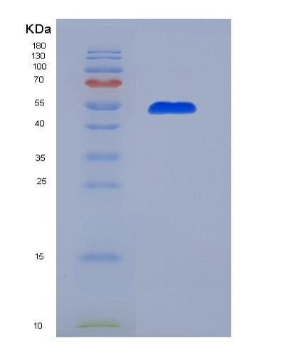 SDS-PAGE analysis of Human F9 (Coagulation Factor Ix) - Recombinant Protein, showing >90% purity under 15% SDS-PAGE (Reduced)